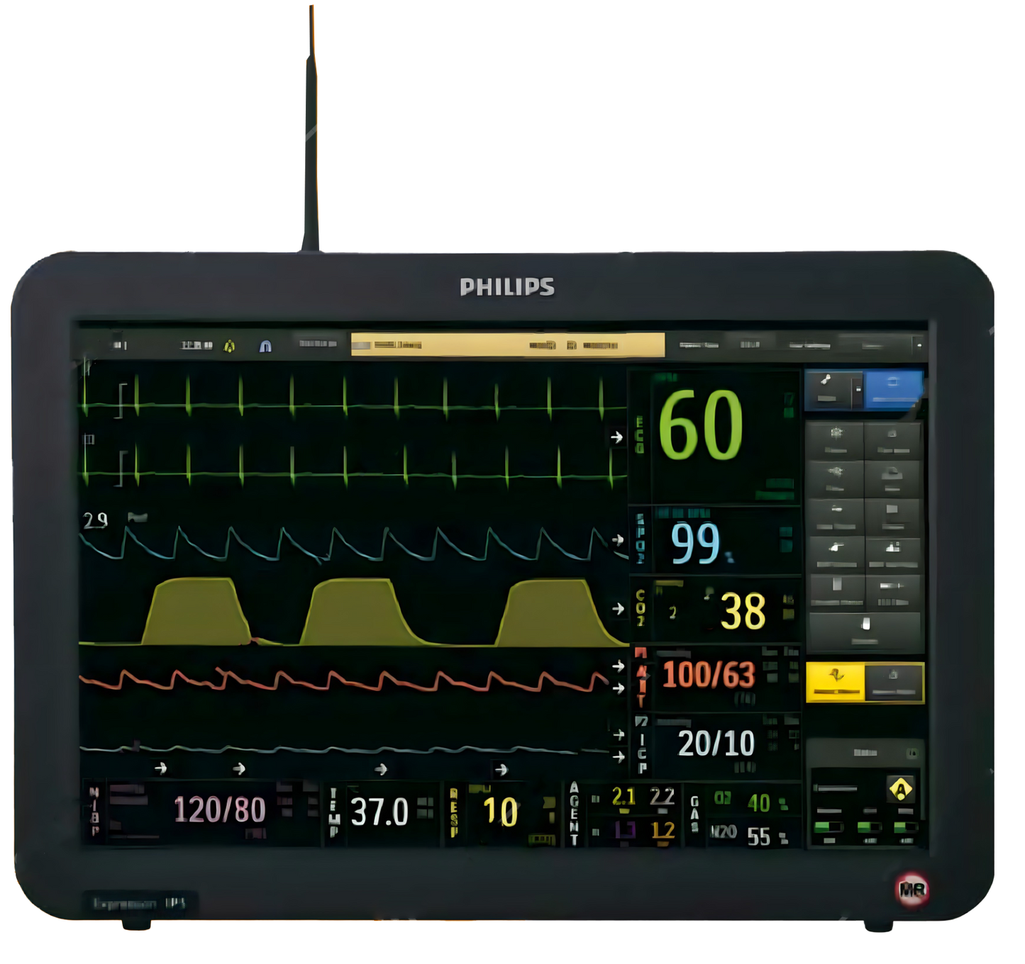 Philips Expression IP5 Monitor