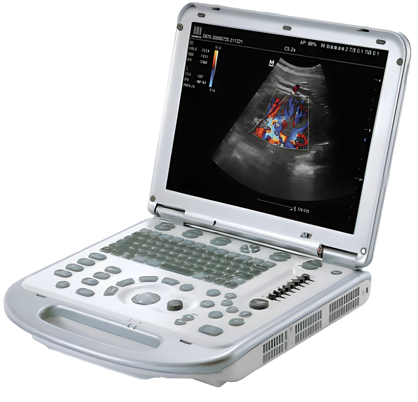 Mindray M7 Portable Ultrasound Machine