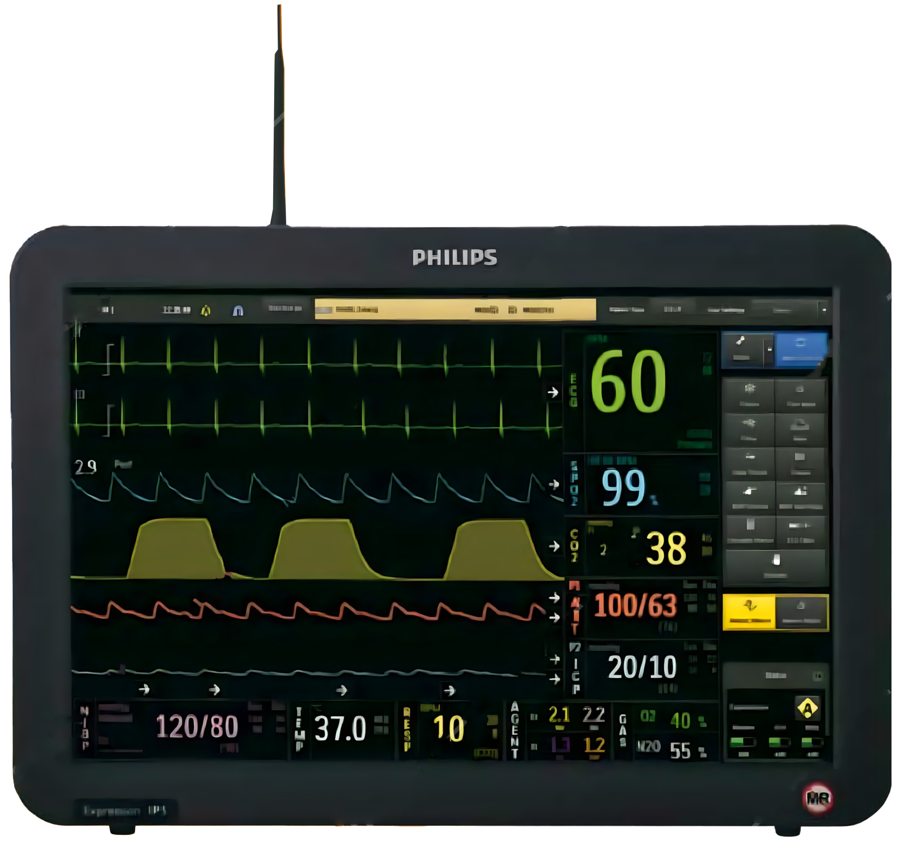 Philips –Philips Expression IP5 Monitor – First Medical