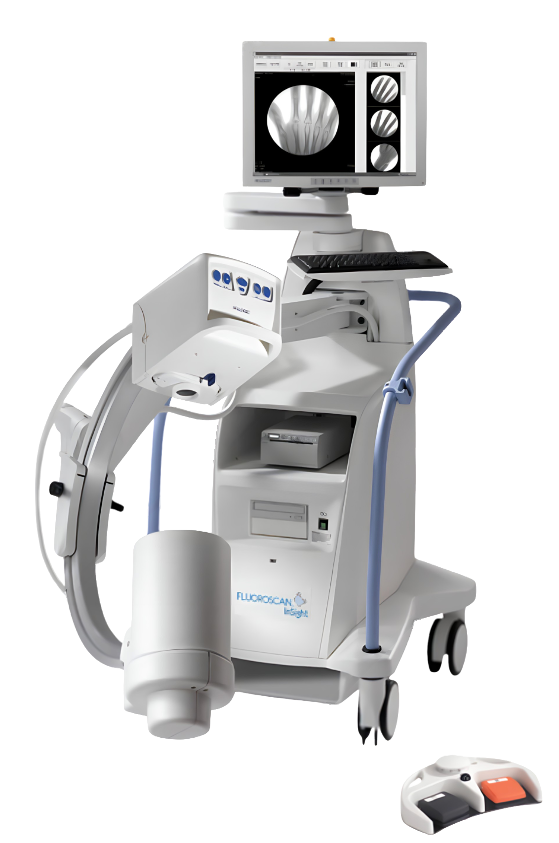 Hologic Fluoroscan InSight 2 Mini C-Arm