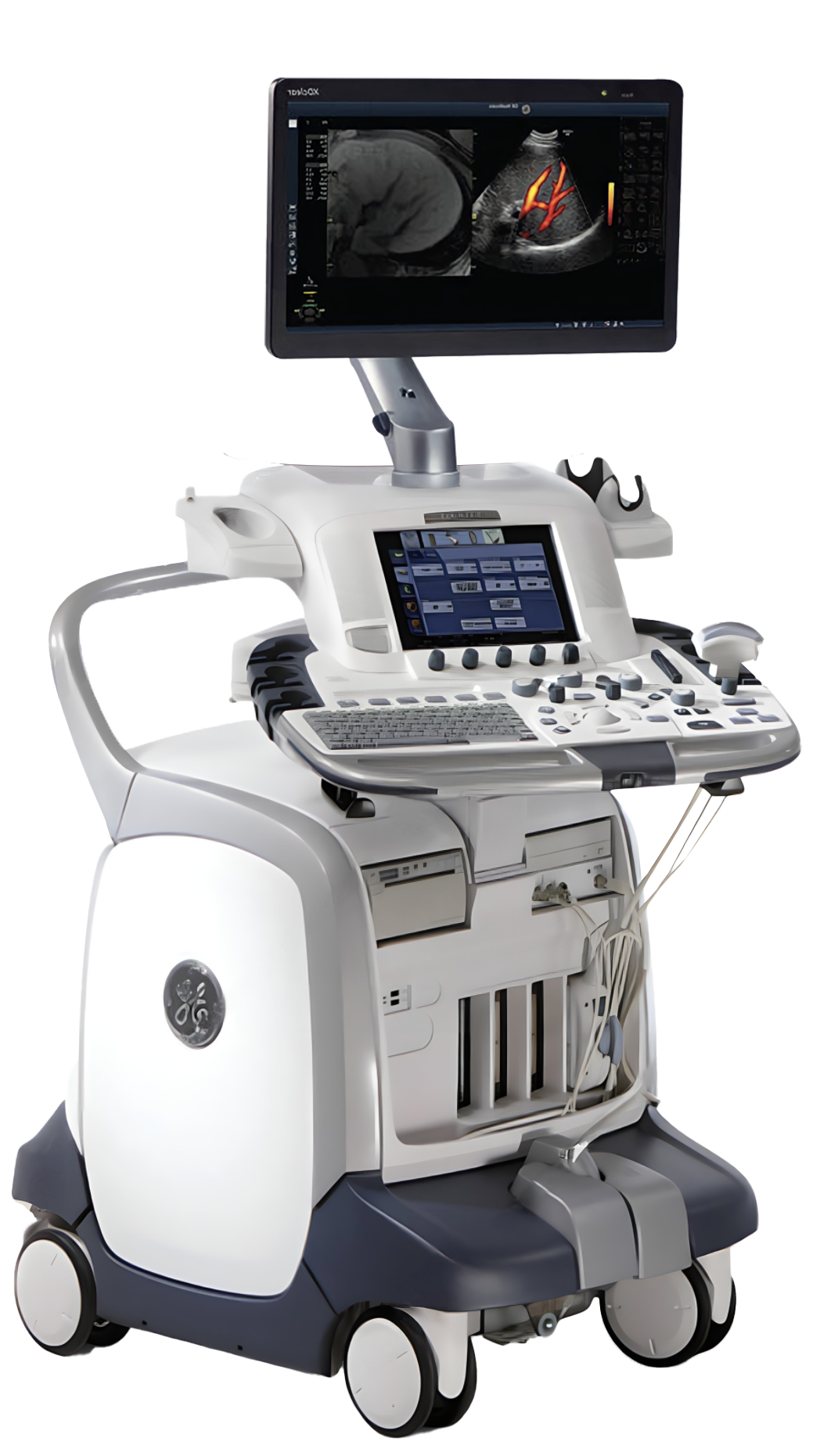 Ge –GE Logiq E9 Ultrasound Machine – First Medical