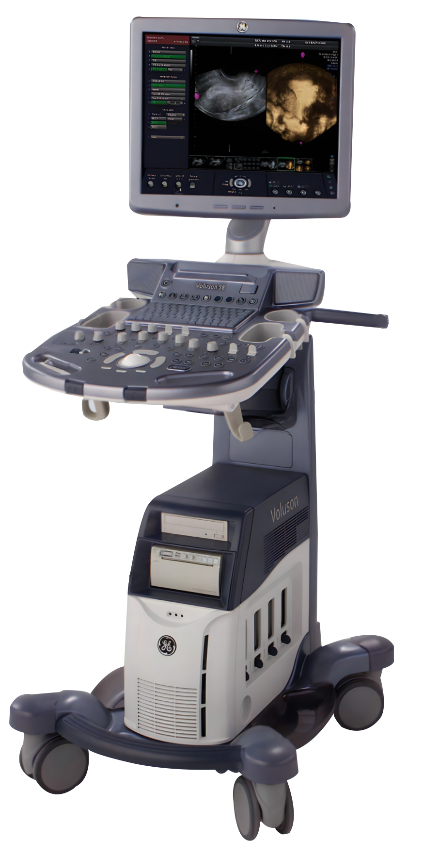 Ge Voluson Ge –GE Voluson S8 Ultrasound Machine – First Medical