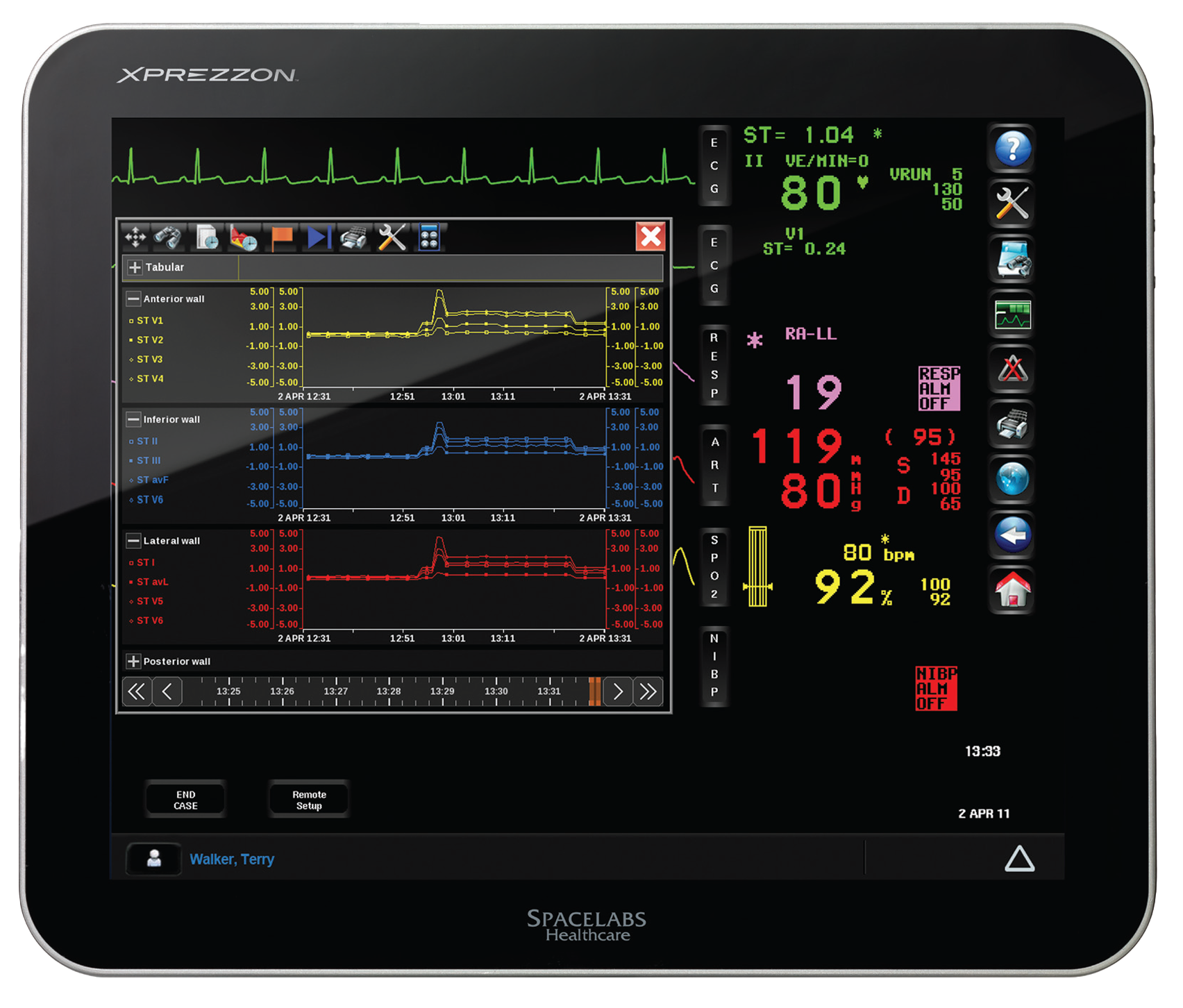 Spacelabs –Spacelabs Xprezzon Monitor – First Medical