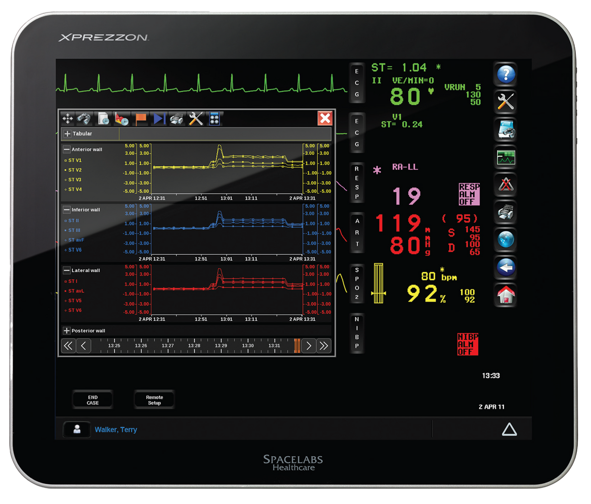 My Lab Monitor Spacelabs –Spacelabs Xprezzon Monitor – First Medical